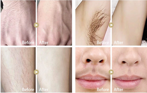 Vĩnh viễn tóc Remover Soprano Ice 808 Diode Laser 755 808 1064 Soprano Ice bạch kim Máy cạo lông làm mát Pad Diode Laser - Product Image 6