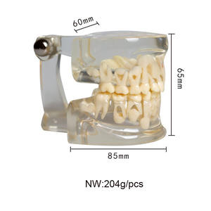 Modelo dental durante el período de dentición alternativa Dentaduras Materiales dentales Modelo de comunicación médico-paciente - Product Image 2