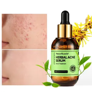 Canlı GLAMOUR bitkisel akne tedavisi Serum yağ kontrolü aydınlatmak besleyici gözenekleri küçültmek kaldır Scars yüz özü