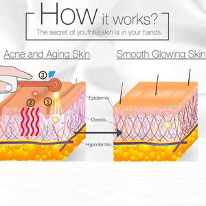 Productos de Belleza para el Cuidado Facial con Terapia de Luz Infrarroja de Alta Frecuencia para Uso Doméstico, Electroterapia para Mujeres - Product Image 4