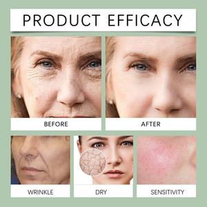 Crème Gelée au Collagène 100g Soin Quotidien Hydratation Intense Amélioration de l'Élasticité Glycérine Spécial Visage - Offre Spéciale - Product Image 6