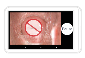 Cầm tay mini <span class=keywords><strong>colposcope</strong></span> cầm tay video kỹ thuật số <span class=keywords><strong>colposcope</strong></span> cho phòng khám phụ khoa sử dụng nhà video colposcopio kỹ thuật số portatil - Product Image 4