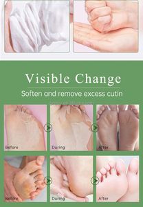 Mascarilla Exfoliante para Pies con Árbol de Té y Menta, Mascarilla para Eliminar Piel Muerta, Nueva - Product Image 5