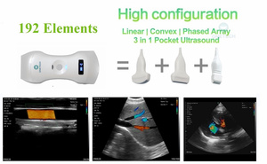 B26G ONETECH Probe <span class=keywords><strong>Ultrasound</strong></span> Nirkabel untuk Diagnosa Umum, Pemindai <span class=keywords><strong>Ultrasound</strong></span> Doppler Warna - Product Image 2