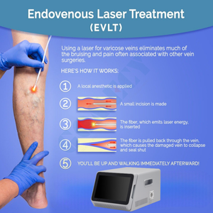 Máquina Láser de Diodo de 1940nm al por Mayor para Eliminación Vascular, Tratamiento de Arañas Vasculares y Dispositivo Profesional de Rejuvenecimiento de la Piel - Product Image 4