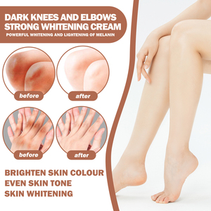 Crema Blanqueadora Profesional para Manos y Dedos - Fórmula Natural para Eliminar Manchas Oscuras en Manos y Dedos - Product Image 4