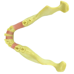 Medico <span class=keywords><strong>e</strong></span> Dentale modello di impianto dentale <span class=keywords><strong>mascella</strong></span> <span class=keywords><strong>mandibola</strong></span> dentale modello di impianto denti modello ganasce - Product Image 3
