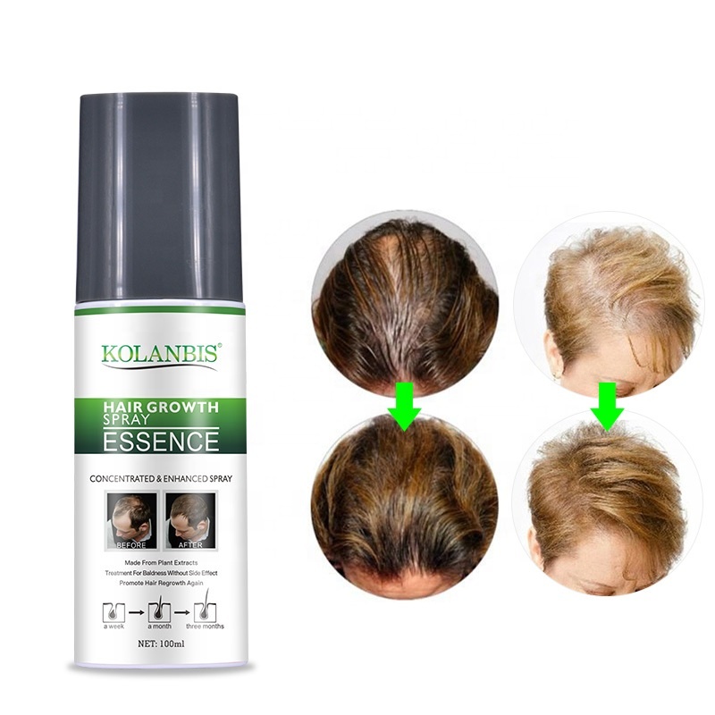 Высококачественный спрей для роста волос, 100% натуральный 100 мл, растительный мгновенный рост волос, Оптовая продажа