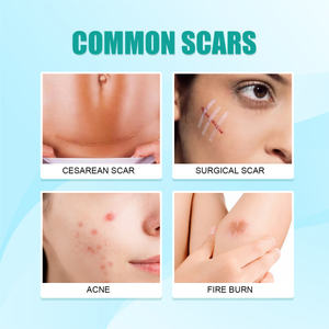 OUHOE Gel de silicona clínicamente probado para el cuidado de la piel Reduce cicatrices y suaviza la reparación de cicatrices durante la cirugía del <span class=keywords><strong>embarazo</strong></span> - Product Image 2