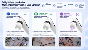 Analizador profesional de cuero cabelludo con chip de IA, pantalla HD de amplio ángulo de visión, equipo de spa para detección de folículos capilares - Product Image 3