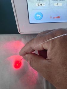 Alat Laser procologi bedah penghilang wasir bubut 1470nm Pilonidal sinus polip <span class=keywords><strong>Anal</strong></span> Fistula Fissure Laser procologic - Product Image 4