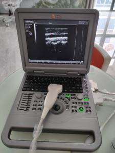 ציוד אולטרסאונד נייד רב לשוני/w ציוד אולטרסאונד אולטרסאונד אבחון רפואי - Product Image 2
