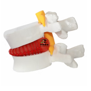 Modelo de Columna Vertebral Interlumbar Humana de Alta Calidad, Modelo Óseo para Enseñanza Médica - Product Image 3
