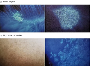 La Herramienta Definitiva para el Análisis de la Piel: Lámpara de Wood Multiusos para la Detección de Pigmentación, Infecciones y Trastornos Metabólicos - Product Image 3