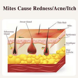 Organico Private Label pelle schiarente alleggerimento bagno sbiancante corpo viso sbiancamento acaro rimozione sapone - Product Image 3