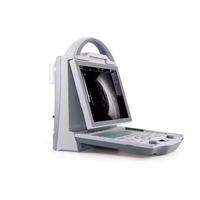 Scanner à ultrasons ophtalmique portable pour les cliniques de santé oculaire Capacités A-Scan et B-Scan pour des diagnostics oculaires complets.