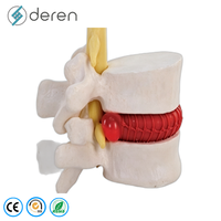 Modelo de Articulación de Cadera Humana a Tamaño Real con Ligamentos, de Silicona Suave y PVC, Modelo Anatómico de Cadera para Uso Médico y Forense