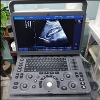 Dispositivo de Ultrasonido Veterinario Portátil Sonoscape E1 EXP V con Monitor HD de 15.6 Pulgadas, Película Protectora Impermeable, Doppler a Color
