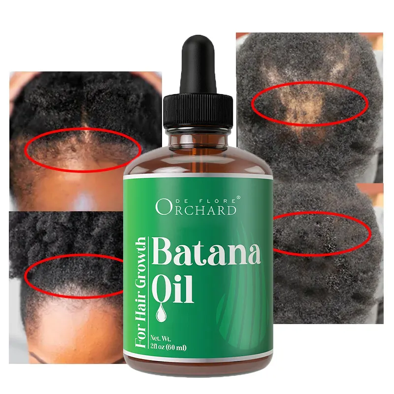 Huile capillaire naturelle et biologique au castor noir de la Jamaïque, nourrit le cuir chevelu et aide à restaurer l'huile de croissance des cheveux Batana plus forte vente en gros