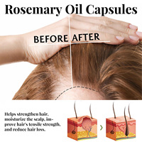 Huile de romarin Capsule de traitement hydratante avec logo personnalisé huile de croissance réparatrice et vitamines pour les cheveux Sérum capillaire Capsules d'huile pour les cheveux