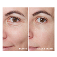 Sérum Visage Anti-Âge Hydratant en Profondeur et Raffermissant à la Capsule de Rétinol Format Voyage, Niacinamide et Acide Hyaluronique pour Éclaircir la Peau