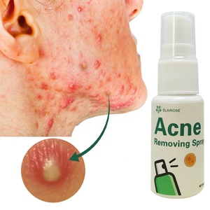 Brume faciale bio végétale anti-acné à l'acide hyaluronique, apaisante et calmante, soin des imperfections, à base d'eau, sans alcool, végétalienne, coréenne - Product Image 3