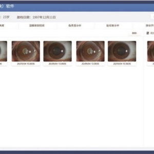 Analyseur professionnel de la sécheresse oculaire, appareil d'analyse de la sécheresse oculaire, biomicroscopie ophtalmologique DEA800 - Product Image 6