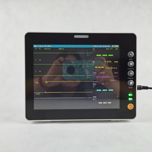 Draagbare veterinaire multiparametermonitor Rsd6000V, <span class=keywords><strong>ECG</strong></span>-recorder voor huisdieren - Product Image 1