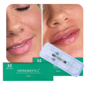 Meilleur <span class=keywords><strong>Prix</strong></span> 1ml 2ml <span class=keywords><strong>Acide</strong></span> <span class=keywords><strong>Hyaluronique</strong></span> de Qualité Cosmétique Dermique pour <span class=keywords><strong>Injection</strong></span>, Remplissage Facial et Lèvres, Technique des Lèvres Russes - Product Image 5