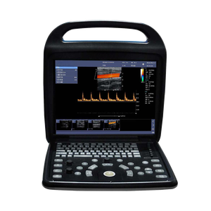 Sistem diagnostik <span class=keywords><strong>Ultrasound</strong></span> warna Digital, untuk penggunaan hewan perangkat pemindai <span class=keywords><strong>Ultrasound</strong></span> portabel - Product Image 5