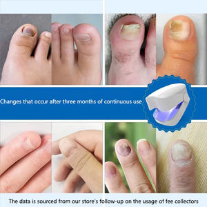 Dispositivo doméstico USB de plástico para limpieza y eliminación de hongos en las uñas de los pies LM - Product Image 4