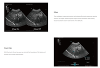 Mindray Vetus Nova Equipo Veterinario Ultrasonido Veterinario Sistema de Diagnóstico por Ultrasonido Completamente Digital Veterinario