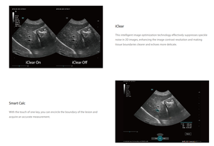 <span class=keywords><strong>Mindray</strong></span> Vetus Nova Équipement vétérinaire Échographie vétérinaire Système de diagnostic à ultrasons numérique complet vétérinaire - Product Image 6