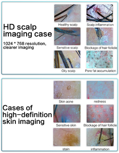 Détecteur de peau à lumière UV Caméra AI Analyse des cheveux et du cuir chevelu Dispositif de beauté à vendre - Product Image 6