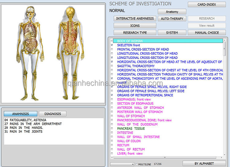 Hot selling 12d aura nls health analyzer with factory price
