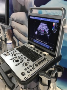 Chison Ebit50 draagbare echografiemachine Kleuren <span class=keywords><strong>Doppler</strong></span> voor OB&GYN, hartmeting met twee probes - Product Image 6
