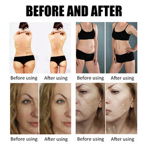 휴대용 3 in 1 448K 치료 장비 병원 물리치료 센터 및 미용 클리닉 도매용 - Product Image 6