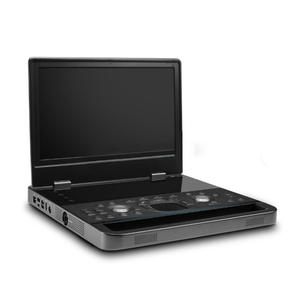 Système d'échographie vétérinaire portable réutilisable Sonoscape ProPet EQ, conçu pour les applications exigeantes sur les animaux de grande taille - Product Image 1