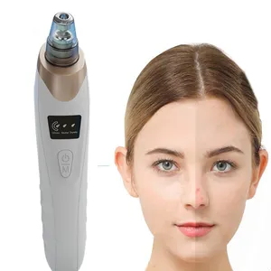 Ménage OEM HY9 absorbeur de points noirs élimination de l'acné outils de nettoyage du visage électrique pores exportation aspirateur Instrument de beauté