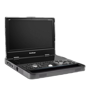 SonoScape E11, Nuevo Diseño, Ecógrafo Doppler Color Digital Portátil Profesional para Animales y Nuevo Producto de Ecografía Veterinaria - Product Image 1