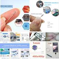 Module de caméra endoscopique OVM6946 USB2.0-Type C HD CMOS 4MP, longueur focale 5-50mm, connectivité médicale 4G, SDK d'usine, CDMO, ISO13485