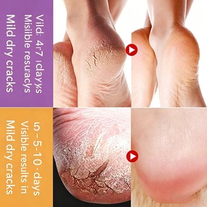 Crema Reparadora para Piel Agrietada |   Ungüento Hidratante y Reparador para Manos y Pies Agrietados - Product Image 2