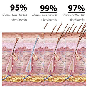 ขายส่ง<span class=keywords><strong>แชมพู</strong></span>ซากุระทําความสะอาดหนังศีรษะอย่างล้ําลึกซ่อมแซมความเสียหายของฟอลลิคูล<span class=keywords><strong>ผม</strong></span> เสริมความแข็งแกร่งของเส้นผมและป้องกันผมร่วง - Product Image 4