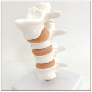 Modelo de lesión de osteoporosis de 4 vértebras médicas, modelo de esqueleto humano, anatomía, articulación, vértebras lumbares, modelo de esqueleto humano - Product Image 2