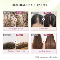 Minyak Esensial Penumbuh Rambut untuk Perawatan Kulit Kepala, Penguatan Rambut, Perawatan Anti Rambut Rontok dengan Minyak Tumbuhan Alami, Pemasok OEM