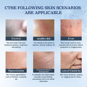 Soins de la peau post-traitement esthétiques médicaux réduisant la réaction inflammatoire Réparation quotidienne du <span class=keywords><strong>visage</strong></span> Gel de collagène recombinant médical - Product Image 5