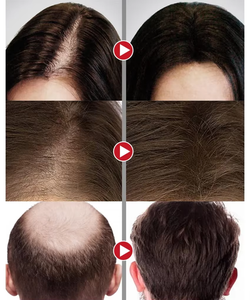 Sérum lissant pour cheveux à la kératine professionnel pour salon, réparation des dommages, soin des cheveux, 1000 ml, traitement à la kératine protéinée - Product Image 6