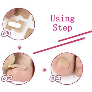 Cinta Adhesiva Correctora para Uñas Encarnadas - Product Image 6