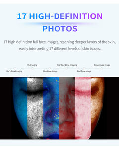 Analizador de Piel Digital 3D Portátil con IA, Analizador de Acné y Pigmentación, con WiFi y Bluetooth, Enchufes US, JP, ZA - Product Image 6