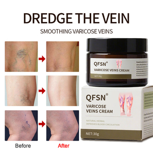 Crema <span class=keywords><strong>de</strong></span> medicina herbaria OEM <span class=keywords><strong>de</strong></span> suministro sanitario <span class=keywords><strong>de</strong></span> fábrica para venas varicosas varicosidad flebitis venas <span class=keywords><strong>de</strong></span> pierna <span class=keywords><strong>de</strong></span> araña - Product Image 6